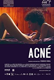 Acné (2008) Free Movie M4ufree
