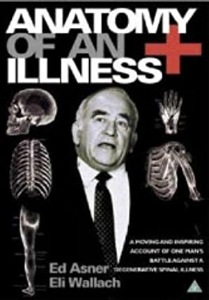 Anatomy of an Illness (1984) Free Movie